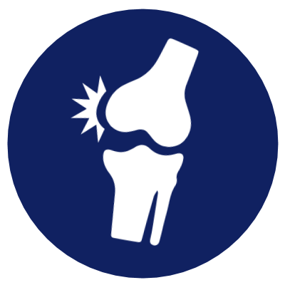 Knee arthritis