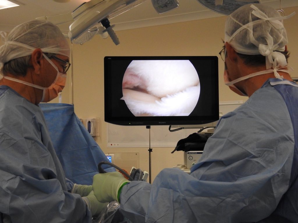 Knee arthroscopy